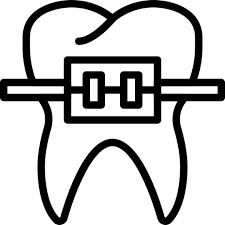 Para pessoas que tem dentes em má posição, o aparelho ortodôntico é o dispositivo utilizado para fazer seu alinhamento.